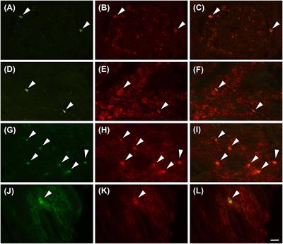 Proteinase Activated Receptor 4 in the Jejunum of Healthy Horses and of Horses With Epiploic Hernia